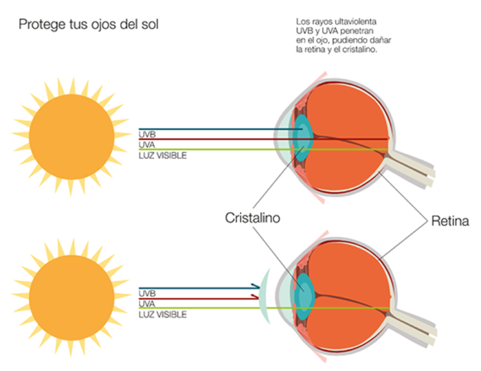 franquicias perfect visions