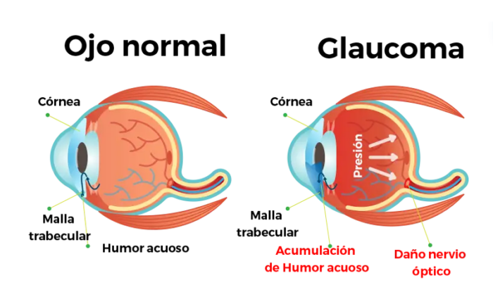 franquicia perfectvisions